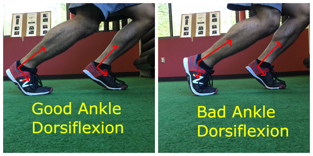 Sprinting - Cause of Lack of Ankle Dorsiflexion