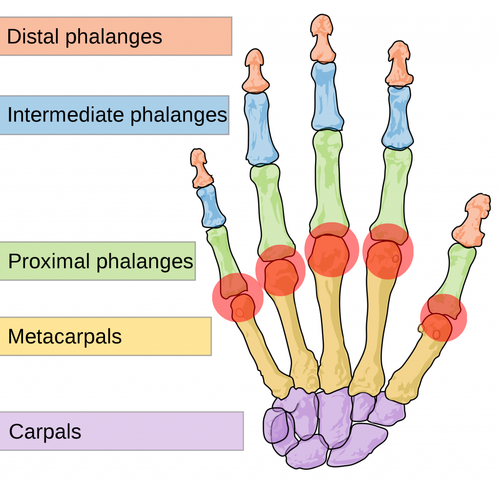 Human Hand - Pressure on Distal Aspect of Metacarpals